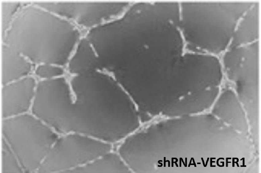 vegfr1icon vegfr1icon