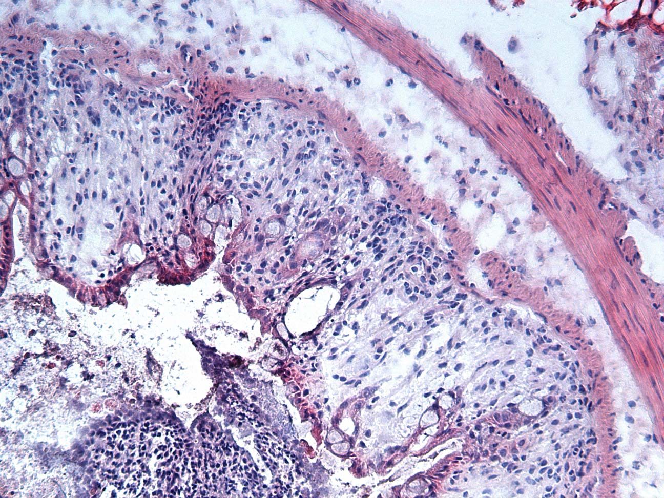 DSS colitis tissue with dss DSS colitis tissue with dss