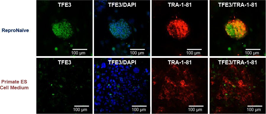 RS11 repronaive pic03 RS11 repronaive pic03