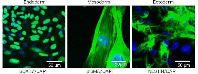 RS11 repronaive pic04 RS11 repronaive pic04