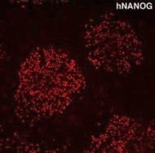 RS14 pluripotency markers ahna RS14 pluripotency markers ahna