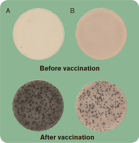 RS22 B Cell ELISpot pic01 RS22 B Cell ELISpot pic01