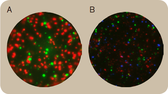 RS22 B Cell ELISpot pic03 RS22 B Cell ELISpot pic03