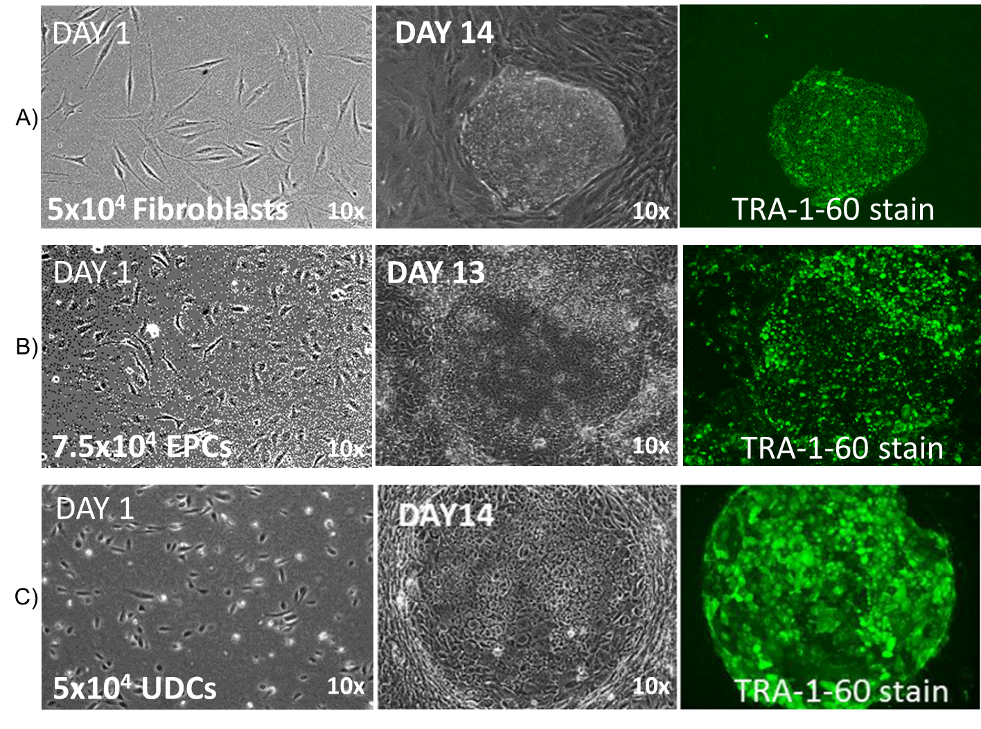 RS56 iPSC colony morphology RS56 iPSC colony morphology