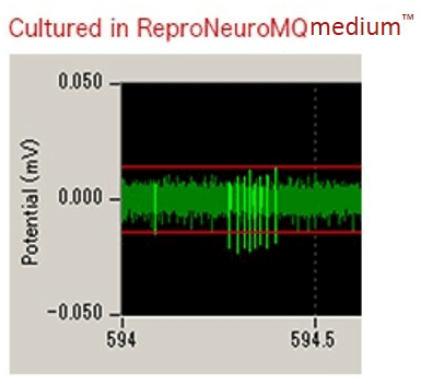 ReproNeuro MQ medium Fig02 ReproNeuro MQ medium Fig02
