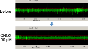 ReproNeuro MQ medium Fig08 ReproNeuro MQ medium Fig08