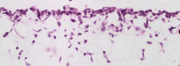 alvetex strata image alvetex strata image