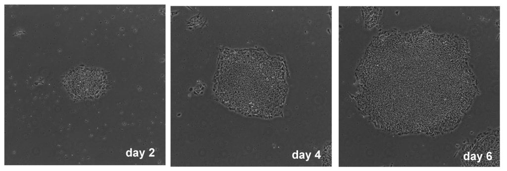 laminin 5 t1 01 laminin 5 t1 01