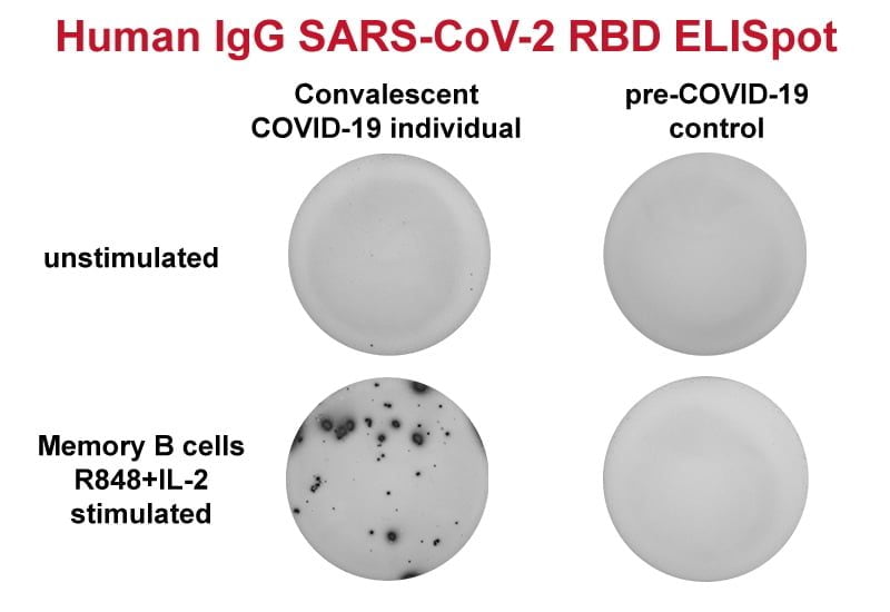 sars cov 2 bcell elispot sars cov 2 bcell elispot